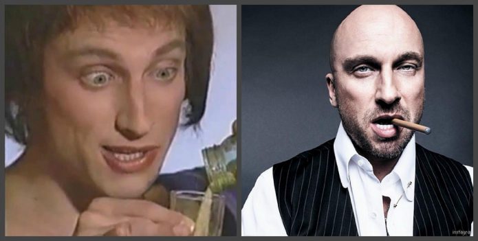 Дмитрий Нагиев зъби преди и след