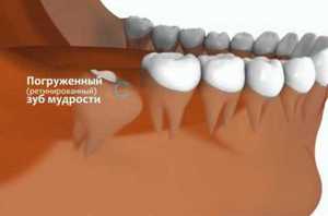 Потопен мъдрец