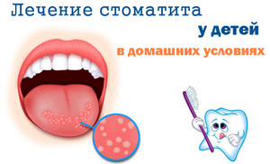 Лечение на стоматит - помощ за деца и възрастни