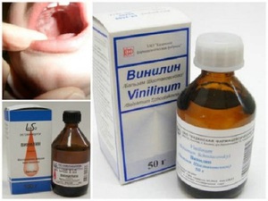 Положителният ефект на Винилина при лечението на стоматит