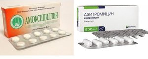 Лечение на зъбния поток