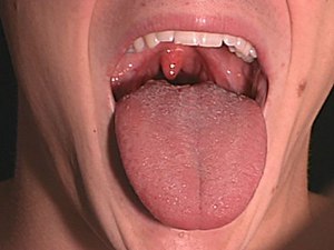 Специални инструкции за използване на паста solcoseryl dental