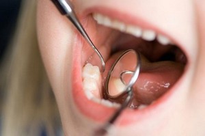 Причини за използване на изплакването Listerine